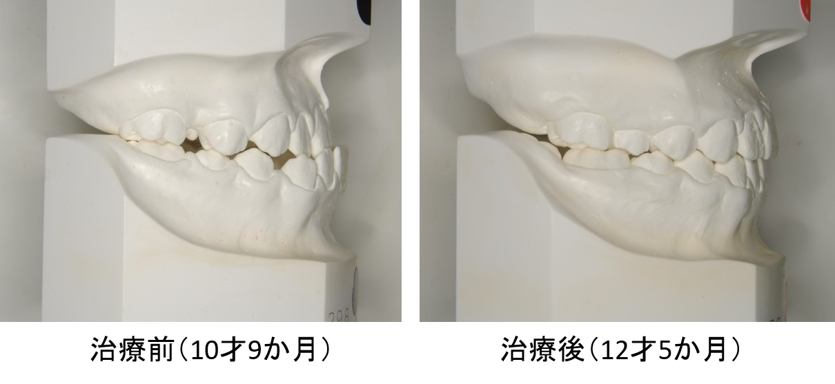 治療前と治療後